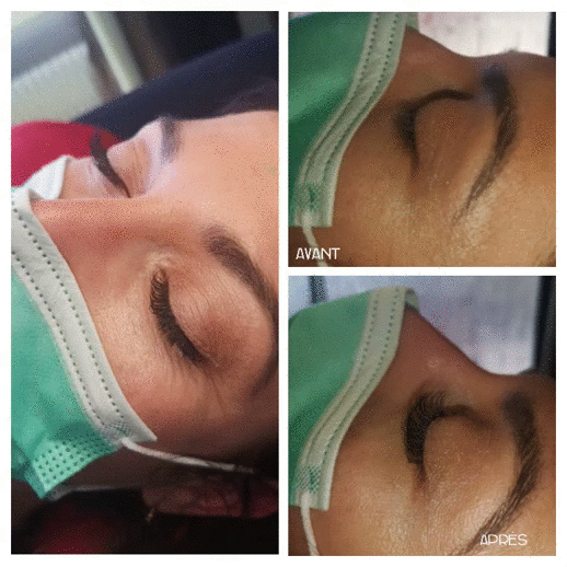 Extension de cils Extension de cils